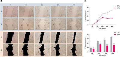 Soluble peptidoglycan fragments produced by Limosilactobacillus fermentum with antiproliferative activity are suitable for potential therapeutic development: A preliminary report